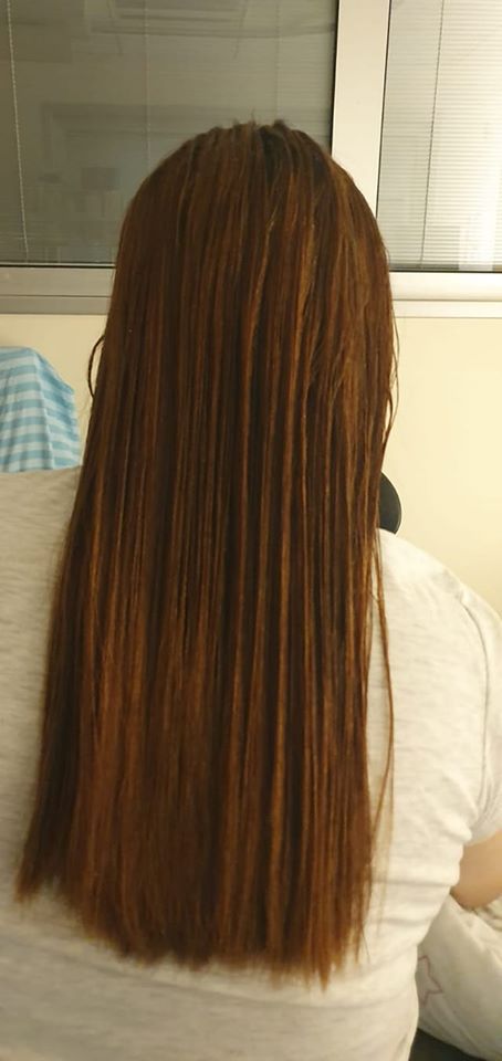 Read more about the article בת 17 עברה החלקת שיער ונמצאת בסכנת חיים
